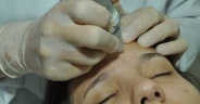 Peeling de Cristal